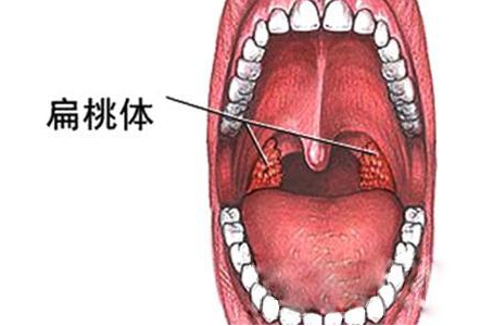 咽喉部解剖扁桃体图片